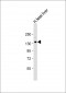 XDH Antibody (N-term)