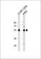 GALR1 Antibody (Center)