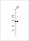 AP9741b-ANKH-Antibody-C-term