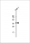 TM173 Antibody (C-term)