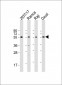 FCRL4 Antibody (C-term)