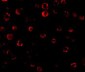 IRAK Antibody