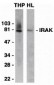 IRAK Antibody