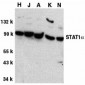 STAT1 alpha Antibody