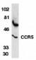 CCR5 Antibody