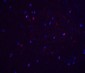 RAIDD Antibody