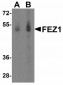 Neurturin Antibody