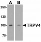 Neurturin Antibody