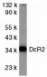 DcR2 Antibody