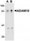 ADAM10 Antibody