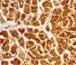 CX3CR1 Antibody