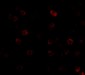 IKK alpha Antibody