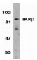 IKK beta Antibody