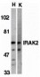 IRAK-2 Antibody