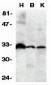 DcR3 Antibody