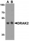 DRAK2 Antibody