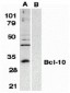 Bcl-10 Antibody