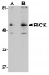 RICK Antibody