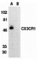 CX3CR1 Antibody