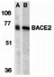 BACE2 Antibody