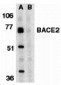 BACE2 Antibody