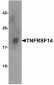 BACE Antibody