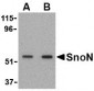 SnoN Antibody