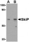 SkiP Antibody