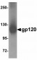 F1A alpha Antibody