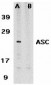 ASC Antibody