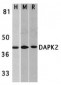 DAPK2 Antibody