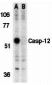 Caspase-12 Antibody