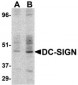 DC-SIGN Antibody