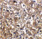 IRAK-M Antibody