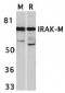 IRAK-M Antibody