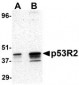 p53R2 Antibody