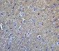 Chk2 Antibody