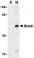 Aven Antibody