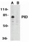 PID Antibody