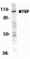 MTBP Antibody