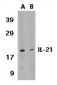 IL-21 Antibody