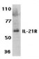 IL-21 Receptor Antibody