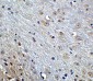 IL-21 Receptor Antibody