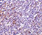 TCCR Antibody