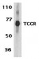 TCCR Antibody