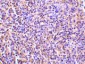 TCCR Antibody