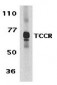 TCCR Antibody