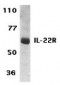 IL-22 Receptor Antibody