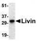 Livin Antibody