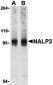 NALP2 Antibody